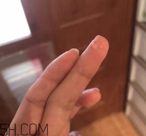 倍舒痕可以去痘印嗎？倍舒痕能涂在痘痘上嗎？