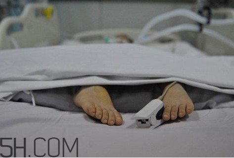 腦死亡是什么意思？腦死亡判定有嚴(yán)格標(biāo)準(zhǔn)