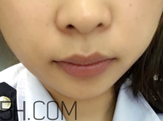 小蜜蜂細(xì)致修護(hù)唇膏很油嗎？夏天用合適嗎？