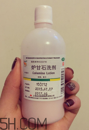 爐甘石洗劑多少錢一瓶？爐甘石洗劑治痤瘡嗎？