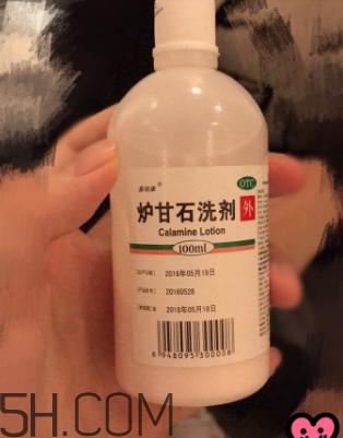 爐甘石洗劑是洗還是擦？爐甘石洗劑是什么顏色？
