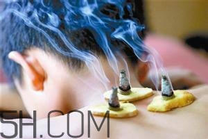 艾灸對(duì)慢性咽炎有用嗎？慢性咽炎可以通過艾灸來治療嗎？