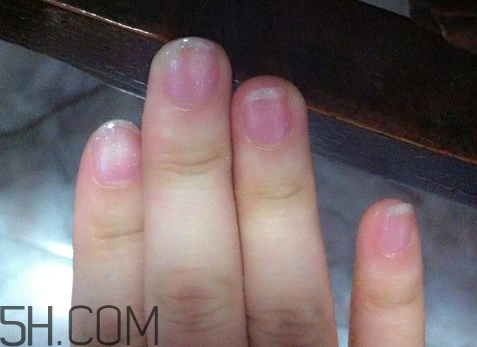 美甲后指甲受損怎么辦？指甲破損怎么修復(fù)？