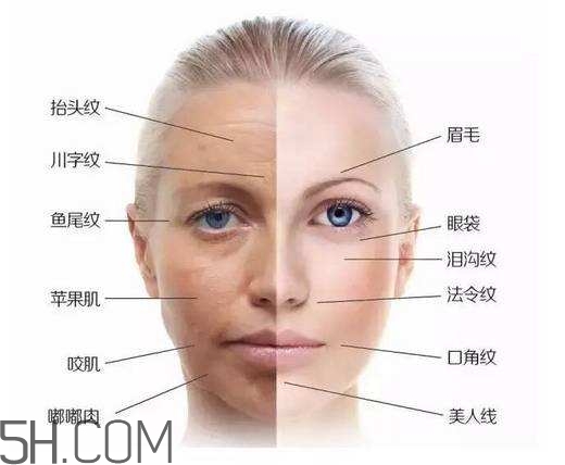 怎么預防皺紋的產(chǎn)生？導致皺紋的產(chǎn)生的原因有哪些？