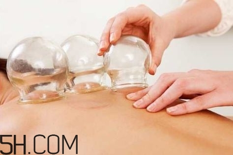 拔罐可以治療鼻炎嗎？鼻炎拔罐拔哪里？
