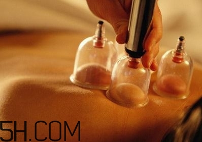 拔罐可以治療鼻炎嗎？鼻炎拔罐拔哪里？
