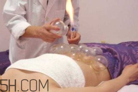 腹部拔罐可以減肥嗎？腹部拔罐拔哪個(gè)位置？
