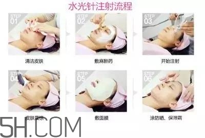 打水光針多久打一次？水光針的誤區(qū)
