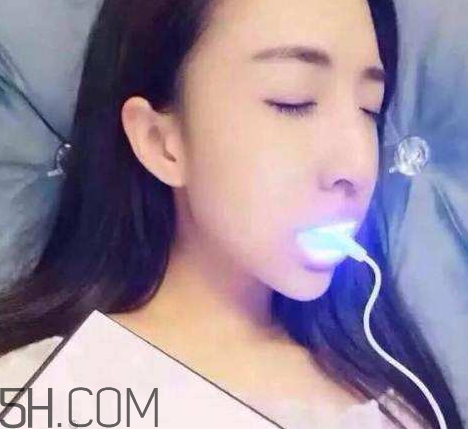 美牙儀可以兩個人用嗎？美牙儀用多久才有作用？