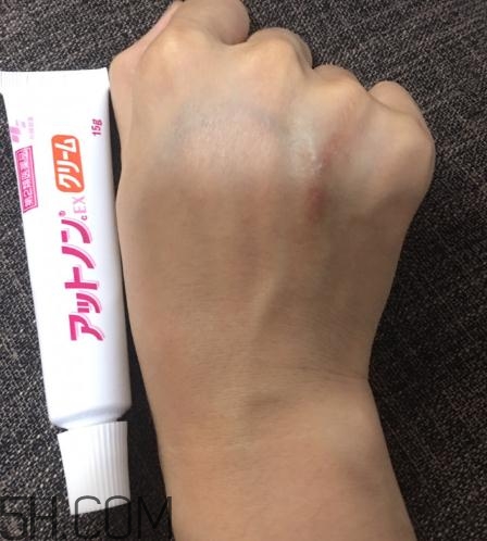 小林制藥祛疤膏有效嗎？小林制藥祛疤膏怎么樣？