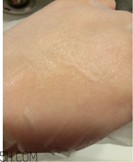 WIS痘肌修護(hù)面膜有效嗎？適合敏感肌嗎？