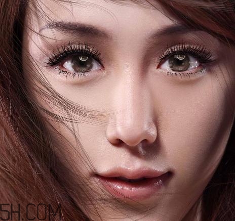 上瞼提肌手術(shù)有必要嗎？上瞼提肌后是永久的嗎？