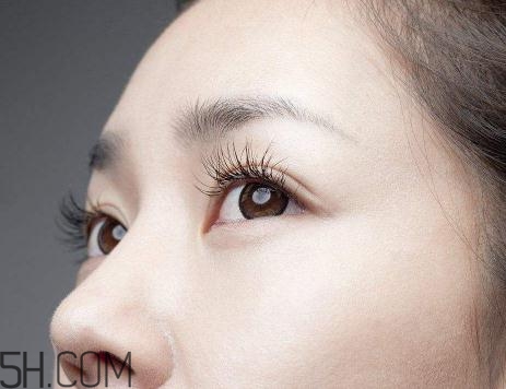 上瞼提肌手術(shù)有必要嗎？上瞼提肌后是永久的嗎？