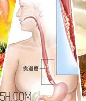 吃太燙會得癌？燙食不僅對胃不好還容易得癌