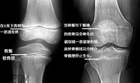 孩子學(xué)街舞好不好？學(xué)街舞好處多多