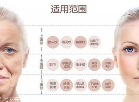 大v線會(huì)斷嗎？一定要選擇正規(guī)整形醫(yī)院