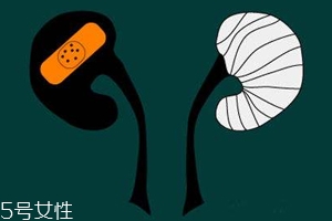 腎病為什么會發(fā)展到尿毒癥？這些因素一定要注意