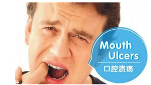 潰瘍的根源在哪里？也許僅僅只是牙膏沒選對