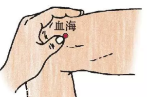 濕疹怎么治才管用？內外同治是關鍵
