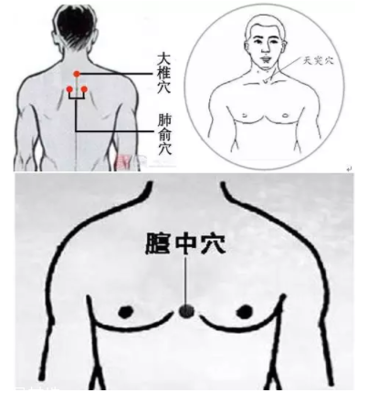 吮痧有什么療效？最溫柔的治病方法