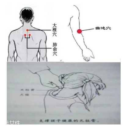 吮痧有什么療效？最溫柔的治病方法