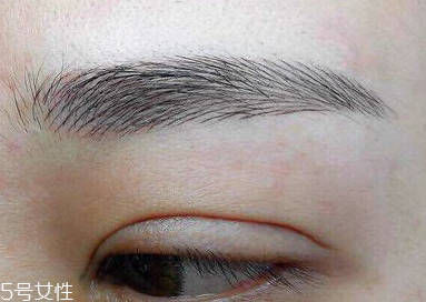 激光洗眉恢復(fù)期有疤痕怎么辦？激光洗眉毛之后正確護理方法