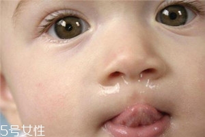 冬季寶寶流鼻涕是什么原因？教你幾招輕松應(yīng)對