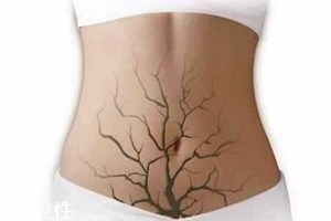 體內(nèi)毒素超標有何表現(xiàn)？五大癥狀須注意