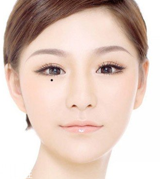 脖子后面有痣代表什么？10大身體缺陷是好事