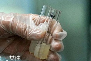 捐精有什么危害？專家稱沒有危害