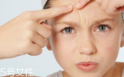 痘痘肌該怎么化妝？這樣化才利于肌膚恢復