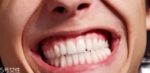 磨牙是因?yàn)槭芰宋?？孩子的心理狀況也會(huì)導(dǎo)致磨牙