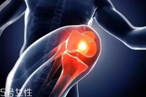 關(guān)節(jié)有響聲是病嗎？?jī)煞N情況區(qū)別對(duì)待