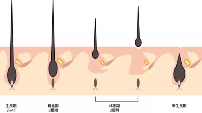 頭發(fā)為什么會(huì)掉？毛囊想休息了