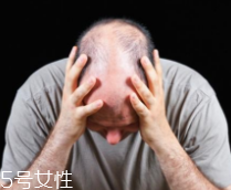 脫發(fā)有沒(méi)有治？只要不是禿子就有得治