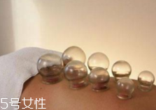 拔火罐引火上身的原因是什么？這4點(diǎn)要注意