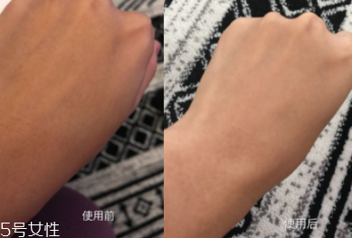 美白精華只能晚上用嗎？白天要做好防曬