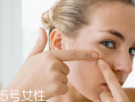 肌膚需要排毒嗎？長痘并不代表排毒