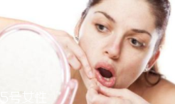 肌膚需要排毒嗎？長痘并不代表排毒