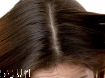 油性頭發(fā)跟什么有關(guān)？離不了這6個原因