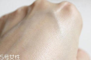 白癜風與身體免疫功能有關系嗎？兩者關系密切