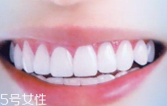 牙線和漱口水是否必要？抑菌護牙好習慣