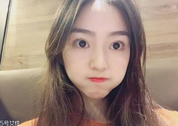 割雙眼皮要注意什么？割雙眼皮充血是正?，F(xiàn)象