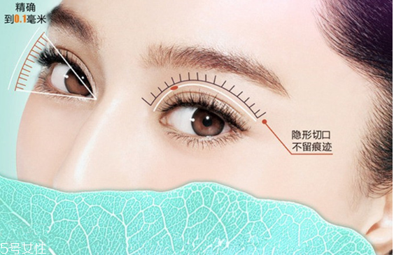 韓式雙眼皮是永久的嗎？圓眼睛不適合做雙眼皮