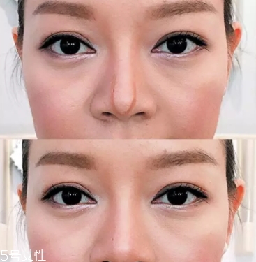 眉粉可以當(dāng)鼻影用嗎？眉粉這樣畫鼻影