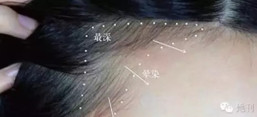 眉粉可以當(dāng)發(fā)際線粉嗎？解救高發(fā)際線的技巧