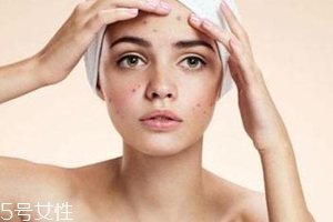 痘痘反復(fù)長(zhǎng)是什么原因？基礎(chǔ)護(hù)膚不夠用心