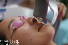 科技脫毛有哪些種類？冰點(diǎn)脫毛不毀毛囊