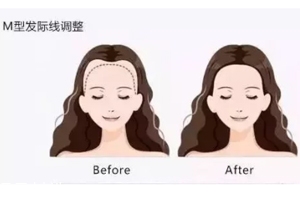 發(fā)際線粉填充和發(fā)際線筆哪個好？配合使用才最完美