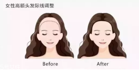 發(fā)際線粉填充和發(fā)際線筆哪個好？配合使用才最完美